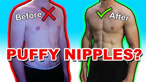 how to get rid of puffy nipples in women|How to Get Rid of Puffy Nipples With and Without Surgery